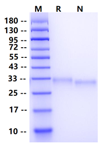 Biotinylated Fc γ RIIB/CD32b Avi&His Tag Protein, Human