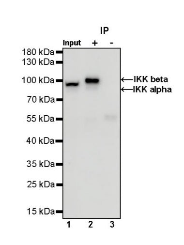IKK alpha/beta Recombinant Rabbit mAb (S-1317-27)