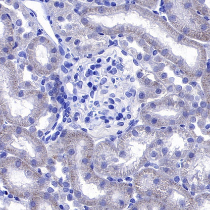 SLIT2 Recombinant Rabbit mAb (S-730-41)