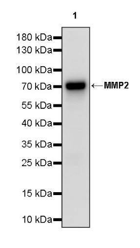 MMP2 Recombinant Rabbit mAb (S-1804-55)