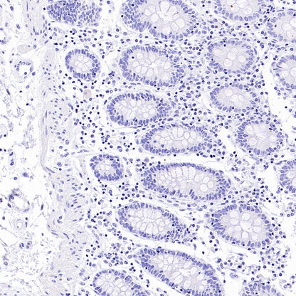MYH7 Recombinant Rabbit mAb (SDT-2936-44)