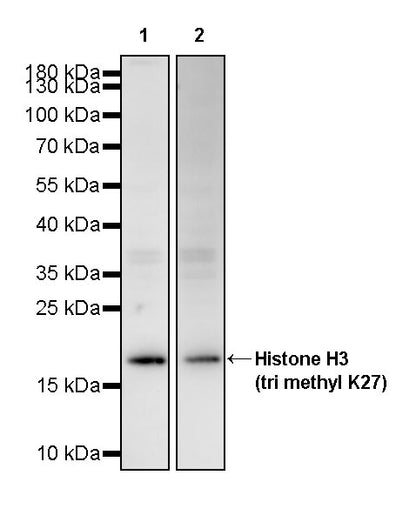 Histone H3 (tri methyl K27) Recombinant Rabbit mAb (S-4331)