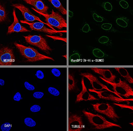 RanBP2 Recombinant Rabbit mAb (S-2593-310)