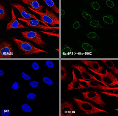 RanBP2 Recombinant Rabbit mAb (S-2593-310)