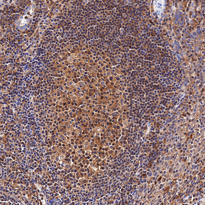 MEK1 Recombinant Rabbit mAb (SDT-308-32)