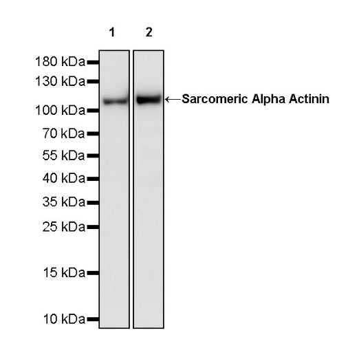 Sarcomeric Alpha Actinin Recombinant Rabbit mAb (S-1652-40)