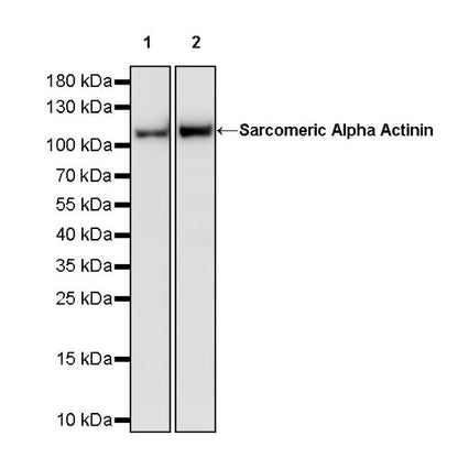 Sarcomeric Alpha Actinin Recombinant Rabbit mAb (S-1652-40)