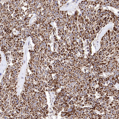 CHMP1a Recombinant Rabbit mAb (S-1651-159)