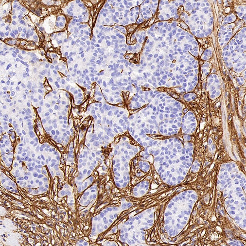 Periostin Recombinant Rabbit mAb (S-2824-17)