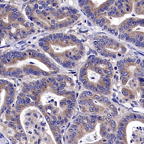 Optineurin Recombinant Rabbit mAb (S-2030-40)