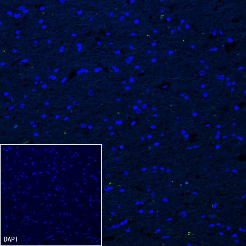 DDX4 Recombinant Rabbit mAb (S-1570-48)