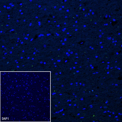 DDX4 Recombinant Rabbit mAb (S-1570-48)