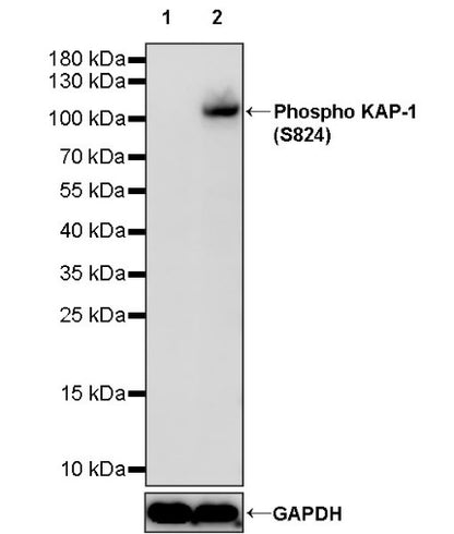 Phospho KAP-1 (S824) Recombinant Rabbit mAb (S-986-9)