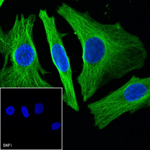 Beta II tubulin Recombinant Rabbit mAb (S-1055-2)