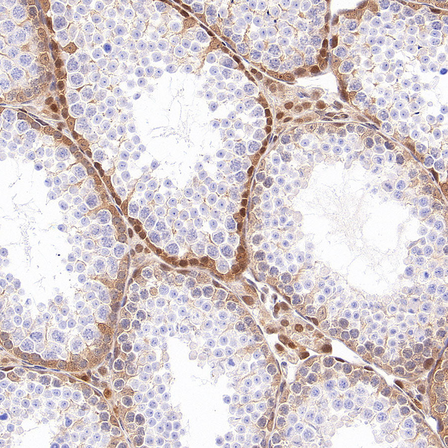 GRB2 Recombinant Rabbit mAb (S-5948)