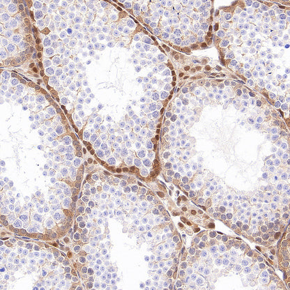 GRB2 Recombinant Rabbit mAb (S-5948)