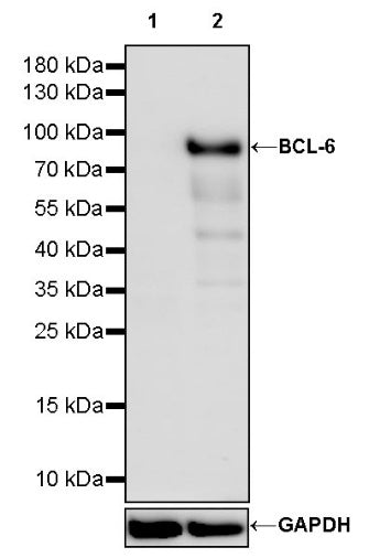 BCL-6 Recombinant Mouse mAb (S-R634)