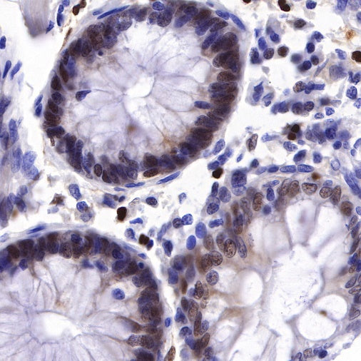 PMS2 Recombinant Rabbit mAb (SDT-111-307)