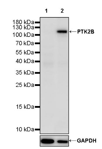 PTK2B Recombinant Rabbit mAb (S-2417-80)