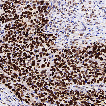 TBX18 Recombinant Rabbit mAb (S-4619-17)