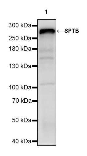 SPTB Recombinant Rabbit mAb (S-755-63)