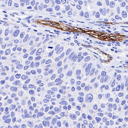 Claudin 5 Recombinant Rabbit mAb (SDT-R322)