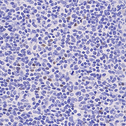 FOXP3 Recombinant Mouse mAb (SDT-3494)