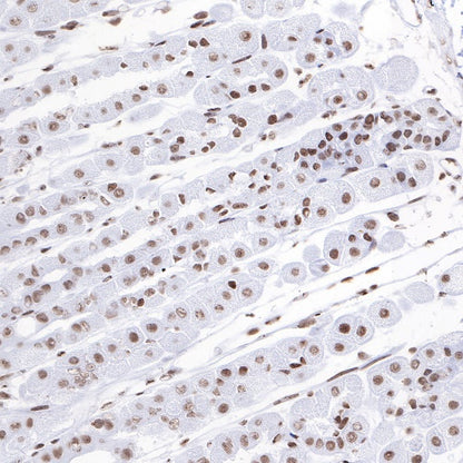 Histone H3 (mono methyl K4) Rabbit polyclonal antibody