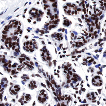 FUBP1 Recombinant Rabbit mAb (SDT-R060)