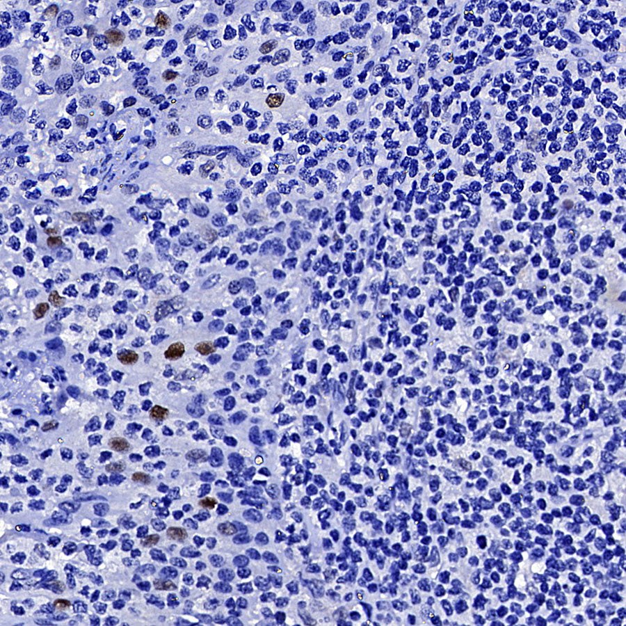 Cyclin E1 Recombinant Rabbit mAb (SDT-4375-29)