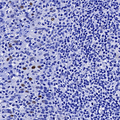 Cyclin E1 Recombinant Rabbit mAb (SDT-4375-29)