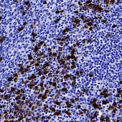 HEG1 Recombinant Rabbit mAb (S-4419-64)