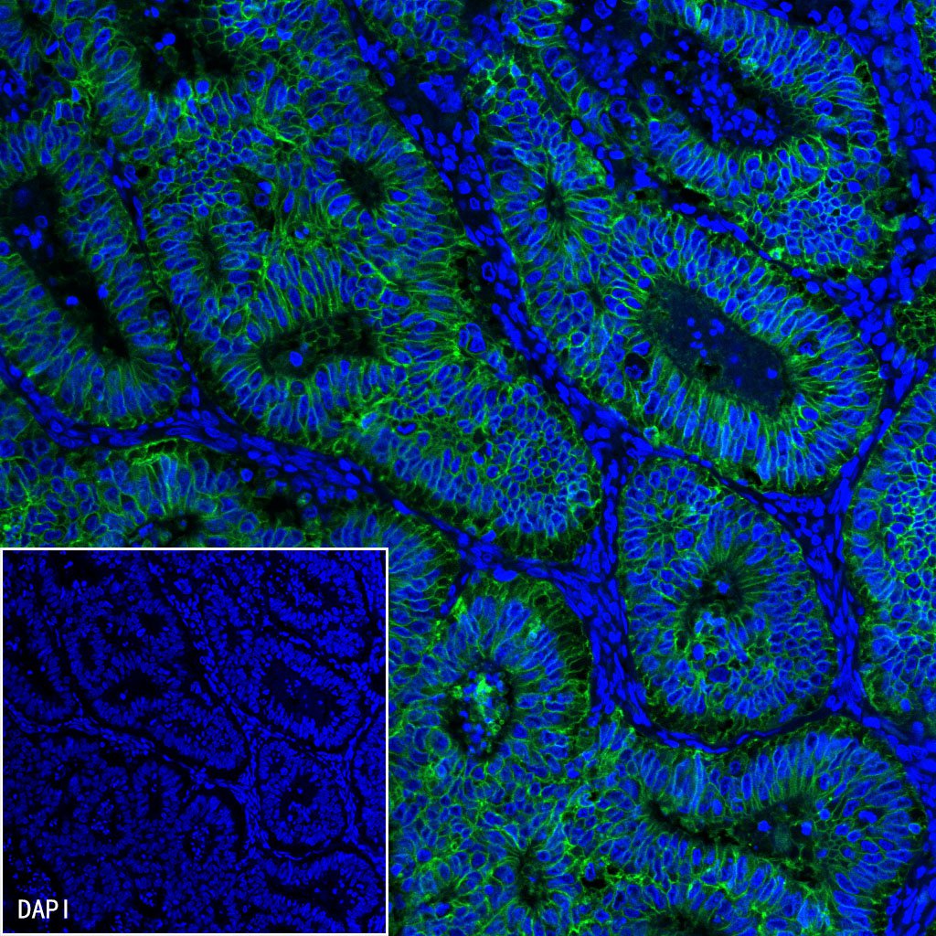 S-RMab® EpCAM Recombinant Rabbit mAb(SDT-078-13)
