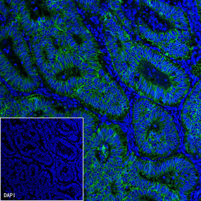 S-RMab® EpCAM Recombinant Rabbit mAb(SDT-078-13)