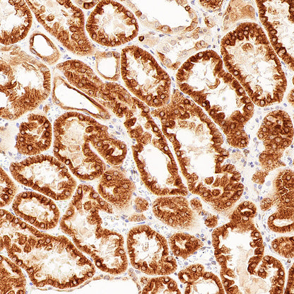 p58IPK/DNAJC3 Recombinant Rabbit mAb (S-4816-205)