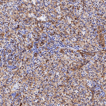 STING Recombinant Rabbit mAb (S-1392-33)