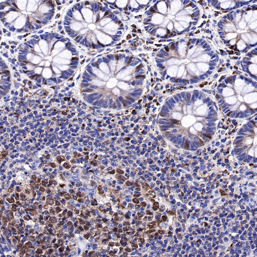 CDK2 Recombinant Rabbit mAb (SDT-064-40)