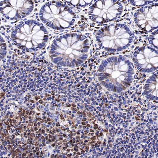 CDK2 Recombinant Rabbit mAb (SDT-064-40)