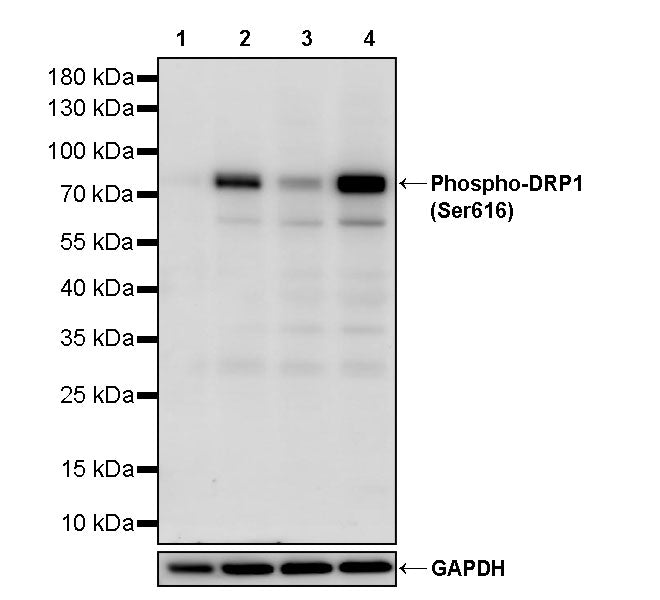 Phospho-DRP1 (Ser616) Recombinant Rabbit mAb (S-4221)