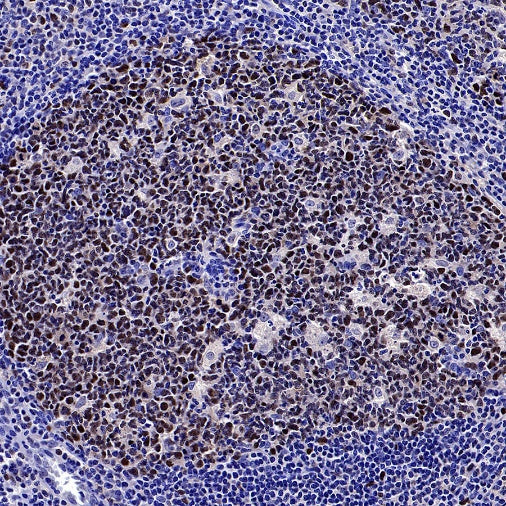 Phospho-NAK/TBK1 (Ser172) Recombinant Rabbit mAb (S-3182)