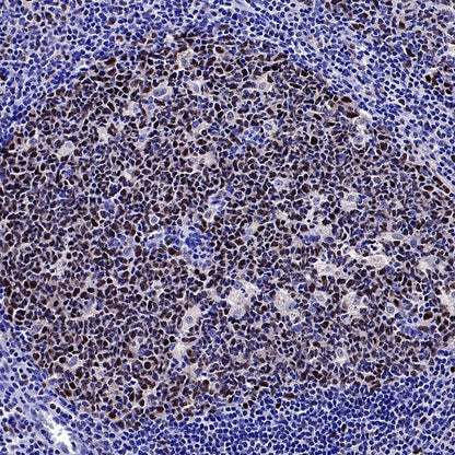 Phospho-NAK/TBK1 (Ser172) Recombinant Rabbit mAb (S-3182)