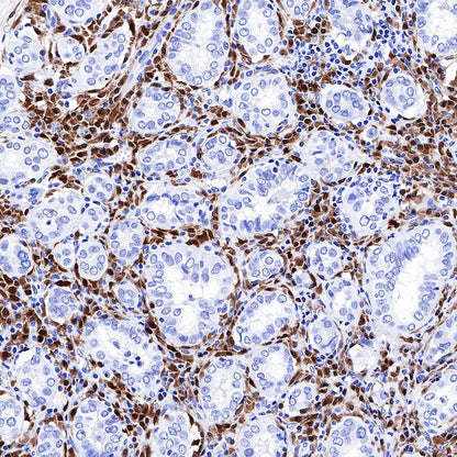 BOB-1 Recombinant Rabbit mAb (SDT-263-55)