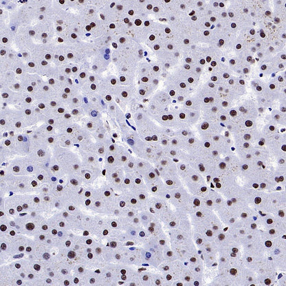 ENT2 Rabbit Polyclonal Antibody