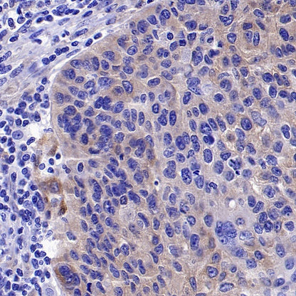 FAK Recombinant Rabbit mAb (S-1180-10)