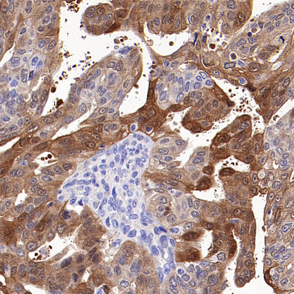 NNMT Recombinant Rabbit mAb (S-3470-58)