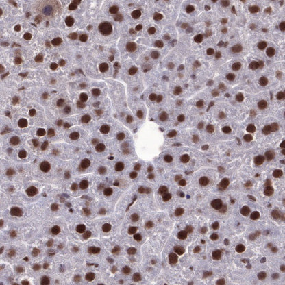 EWSR1/EWS Recombinant Rat mAb (S-R201)