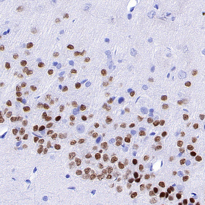 TBR1 Recombinant Rabbit mAb (S-1102-34)