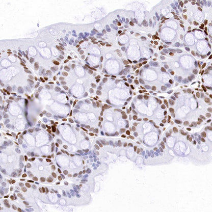 Phospho-Histone H3 (Ser28) Recombinant Rabbit mAb (S-1025-45)