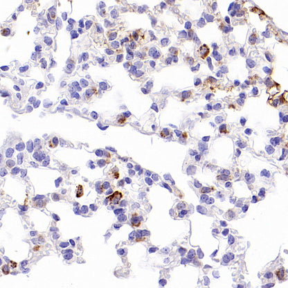 Napsin A Recombinant Mouse mAb,PBS Only (SDT-4204)