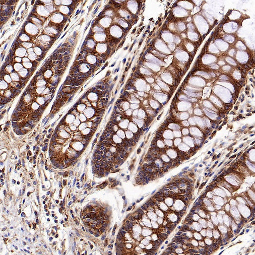 Clathrin heavy chain Recombinant Rabbit mAb (S-1690-25)
